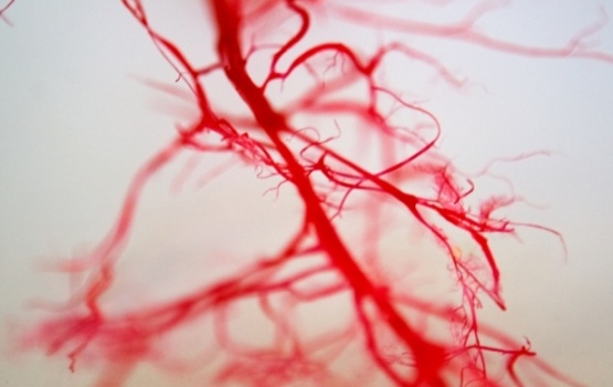 arteries